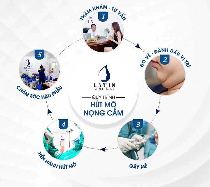 Quy trình hút mỡ nọng cằm