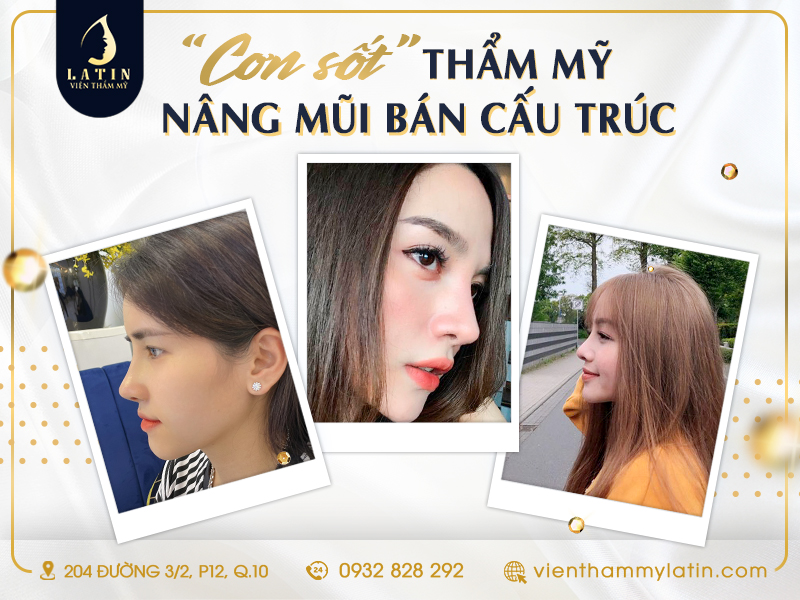 Cơn sốt thẩm mỹ nâng mũi bán cấu trúc