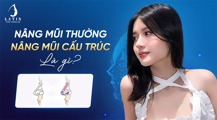 Nâng mũi thường và nâng mũi cấu trúc là gì