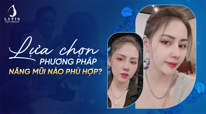 Lựa chọn phương pháp nâng mũi nào phù hợp