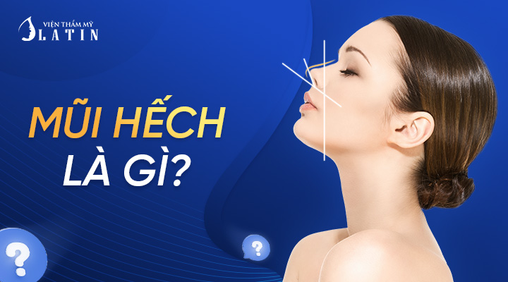 Mũi Hếch và Địa Chỉ Sửa Mũi Hếch Uy Tín