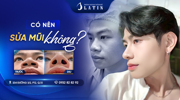Có Nên Sửa Mũi