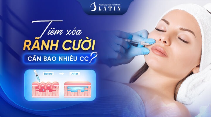 Tiêm rãnh cười bao nhiêu CC