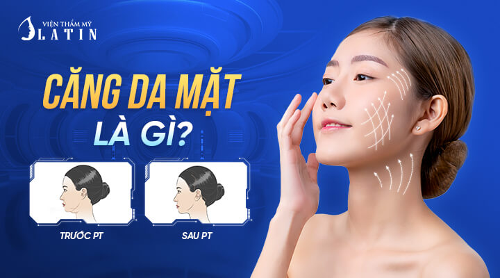 Căng Da Mặt Là Gì