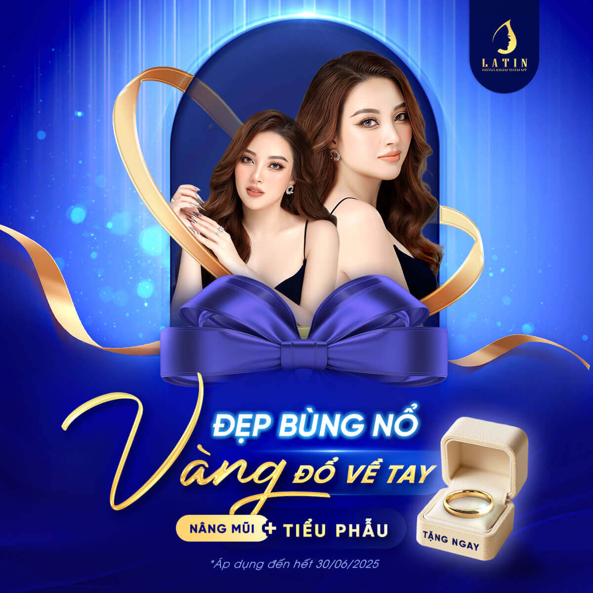 Đẹp Bùng Nổ - Vàng Đổ Về Tay