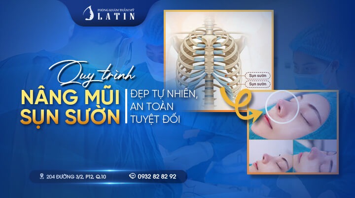 Quy trình nâng mũi sụn sườn