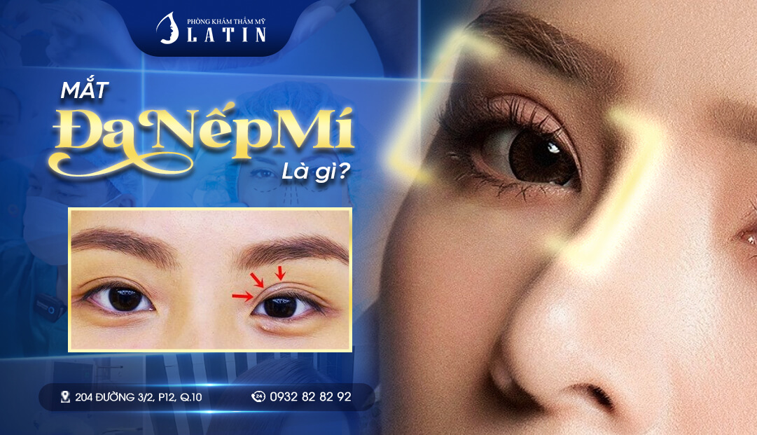 Cắt mí bao lâu thì nếp mí nhỏ lại - Bí quyết để mí đẹp nhanh hơn