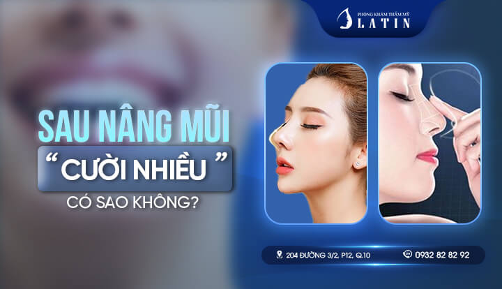 SAU NÂNG MŨI CƯỜI NHIỀU CÓ SAO KHÔNG
