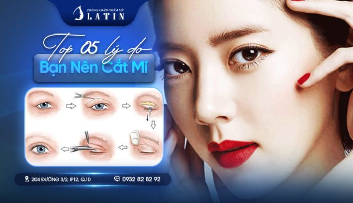 Top 5 lý do bạn nên cắt mí