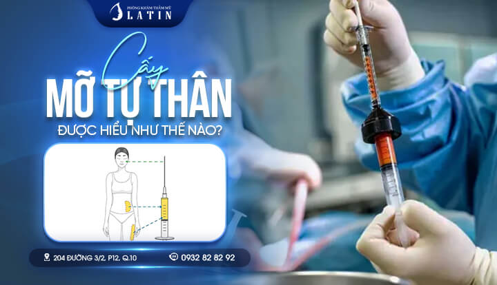 Cấy mỡ tự thân được hiểu như thế nào