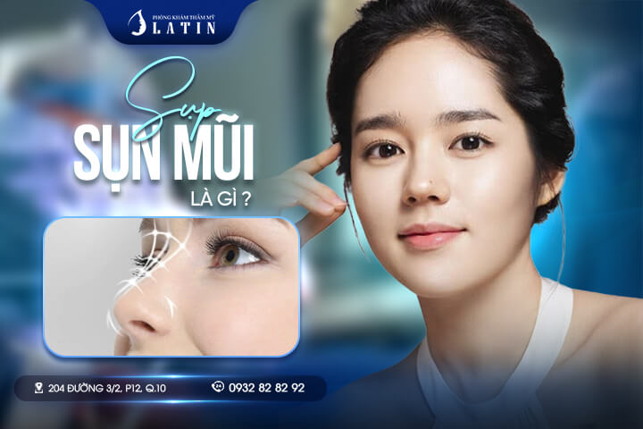 Sụp sụn mũi là gì