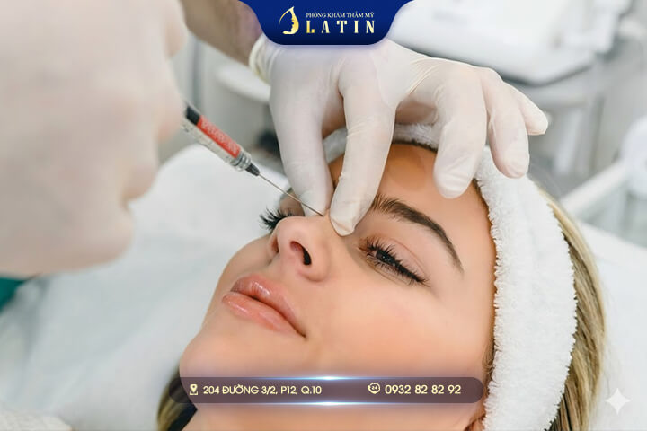 Ai Nên Nâng Mũi Cấu Trúc