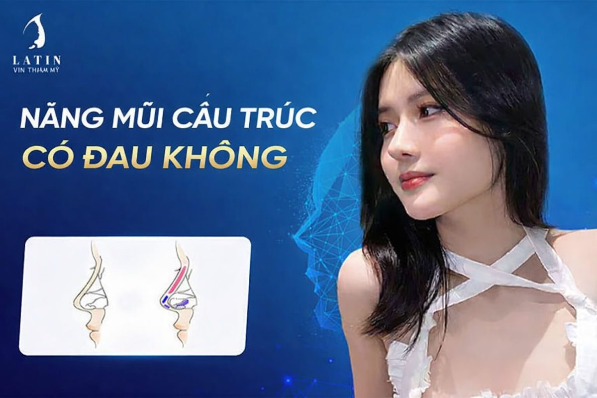 Nâng mũi cấu trúc có đau không