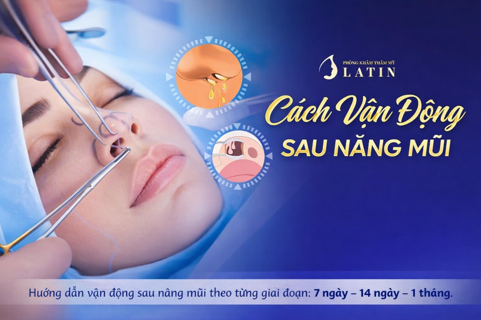 cách vận động sau nâng mũi theo từng giai đoạn hồi phục