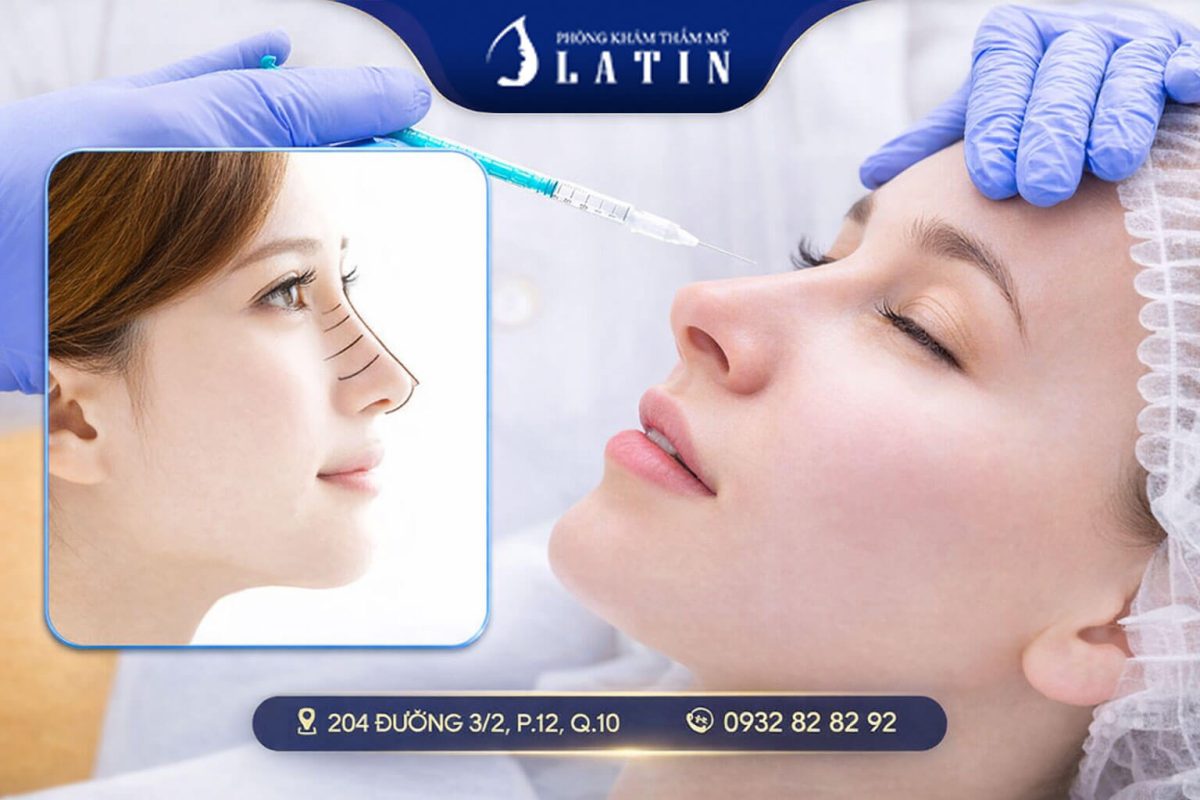 Chăm Sóc Mũi Sau Nâng Dịp Tết 2026