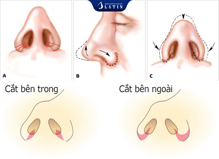 Địa chỉ thu cánh mũi